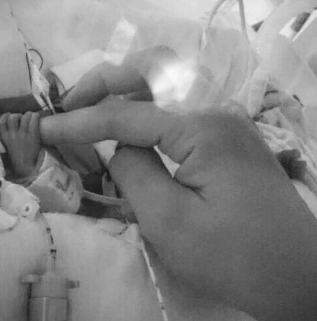 Baby Albie died when he was just five days old.