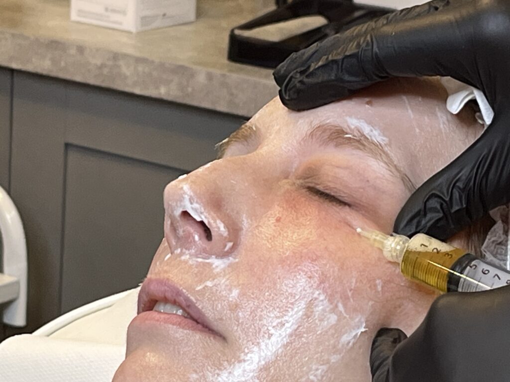 Plasma is injected into Laura's face.