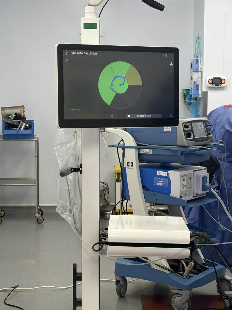 The robot used in the surgery.